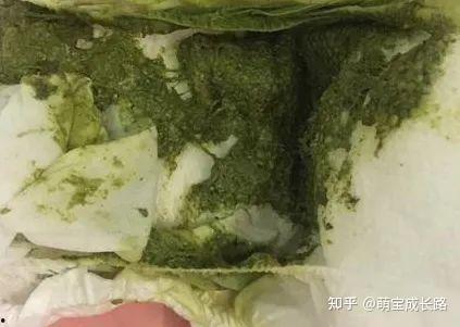 吃瓜大便颜色绿,揭秘吃瓜大便的神秘色彩